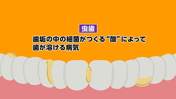 20250425193150-bfc222185fcc3db7ed0f12a32434ad9ebebe6f13.jpg