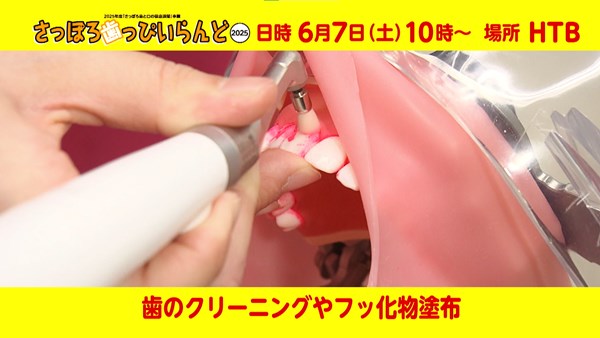 歯のクリーニングとフッ化物塗布参考画像