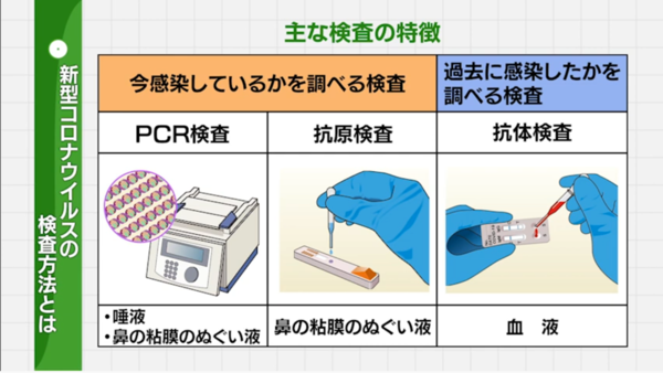 ストーム コロナ サイトカイン